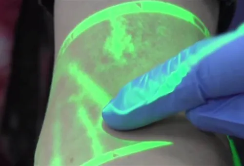 This Gadget Reveals Exactly Where Veins Are, So Nurses Don't Stab You Blindly
