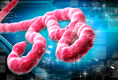 What Makes The Ebola Virus So Deadly?