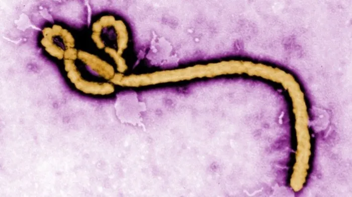 Ebola in Sri Lanka?