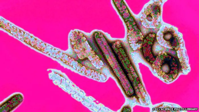 Ebola - What you need to know